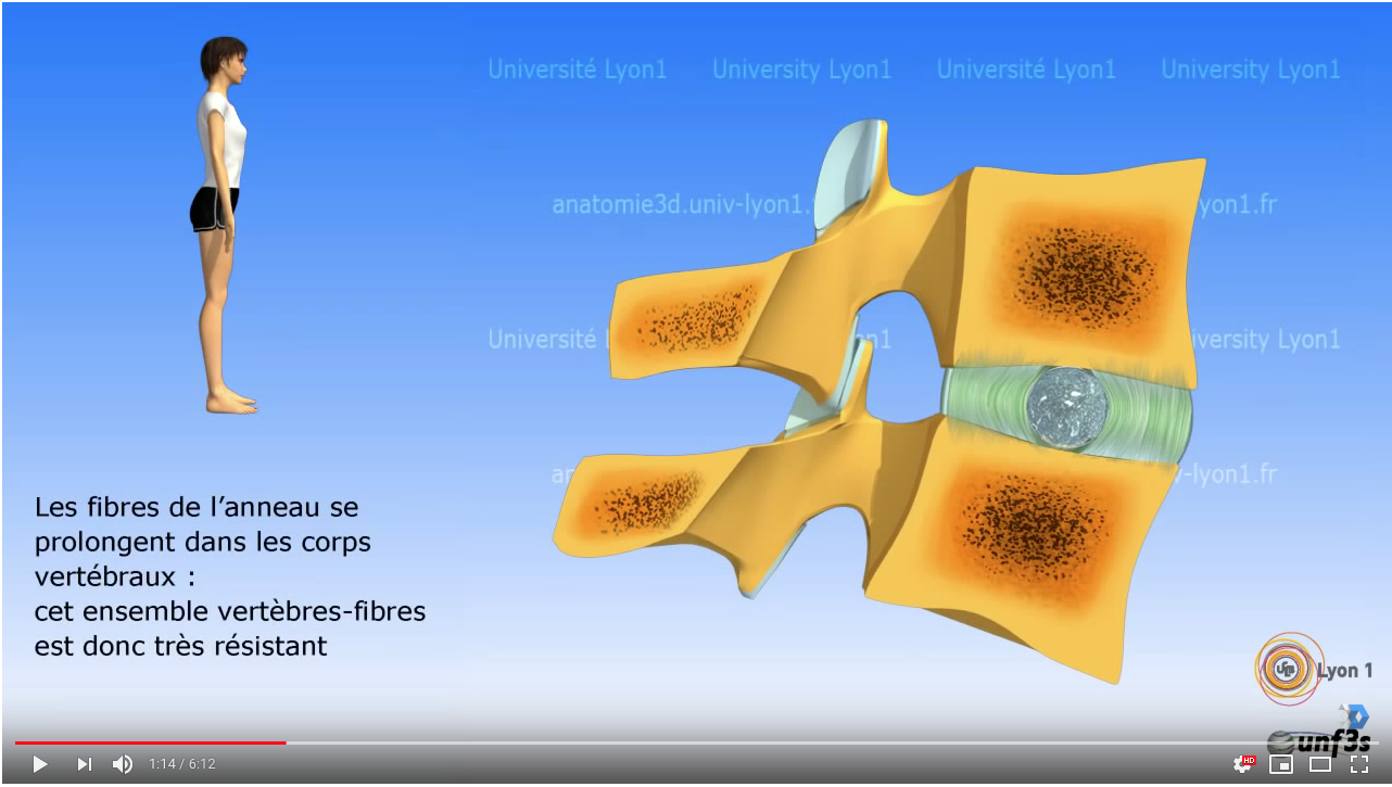 Comment Soigner La Discopathie De Type Modic 1